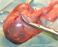 Een cysteus ovarium is er operatief met een OVE uitgehaald